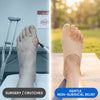 Bunion Corrector for Women Big Toe, Men Too – Ultra-Thin Bunion Sock Separates Big Toes.